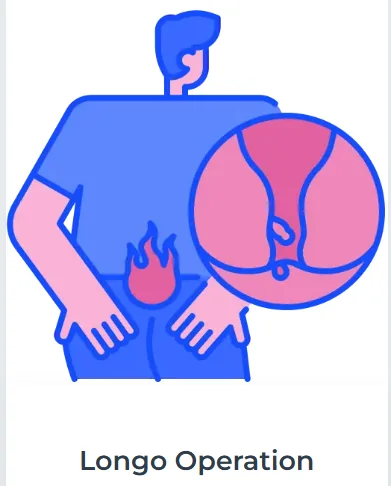 Longo Operation illustration